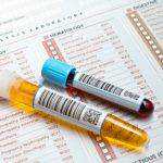 Методы лечения гепатомегалии и прогноз